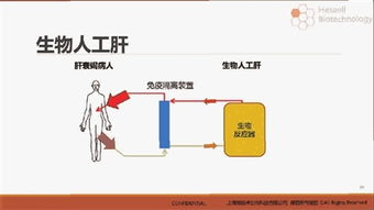 人工肝醫(yī)保 人工肝治療費用
